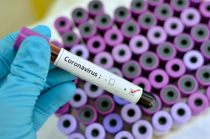 Coronavírus e a importância de uma higienização correta.